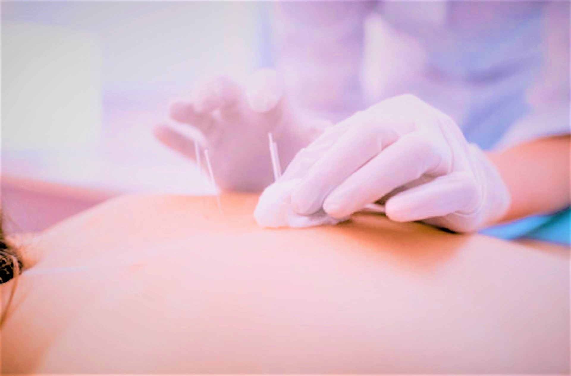 Acupunctura dezechilibru energetic