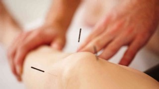 acupunctura provital